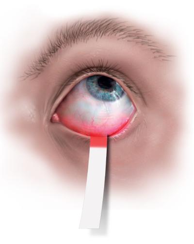 Tørre øjne – irritationsmoment for mange ældre Øjenforeningen