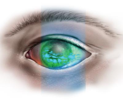 Tørre øjne – irritationsmoment for mange ældre Øjenforeningen
