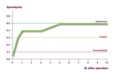 Graf der viser sammenhængen mellem synstyrke / år efter operationen.