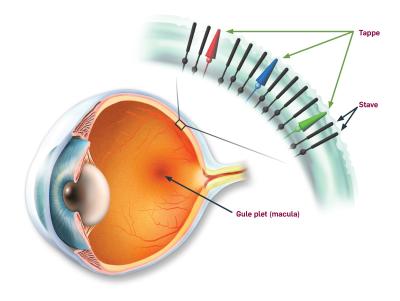 Arvelige øjensygdomme hos børn og unge