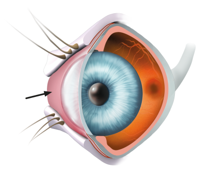 Model af et øje som viser lagende i øjet