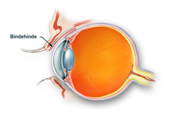 Øjets bindehinde markeret på tværsnit af øjet 