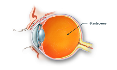 Øjets glaslegeme også kaldet Corpus vitrium, markeret på tværsnit af øjet 