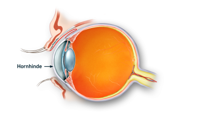 Øjets hornhinde markeret på tværsnit af øjet 