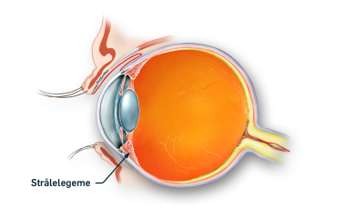 Øjets strålelegeme markeret på tværsnit af øjet 