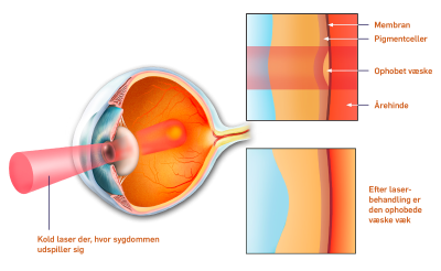 Tværsnit af øjets indre